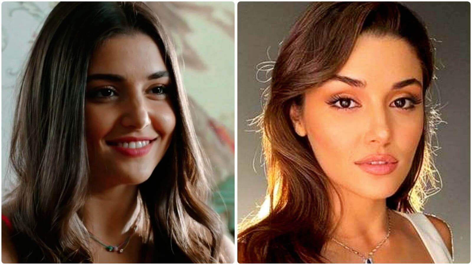 Эрчел Ханде до&nbsp;и&nbsp;после пластики