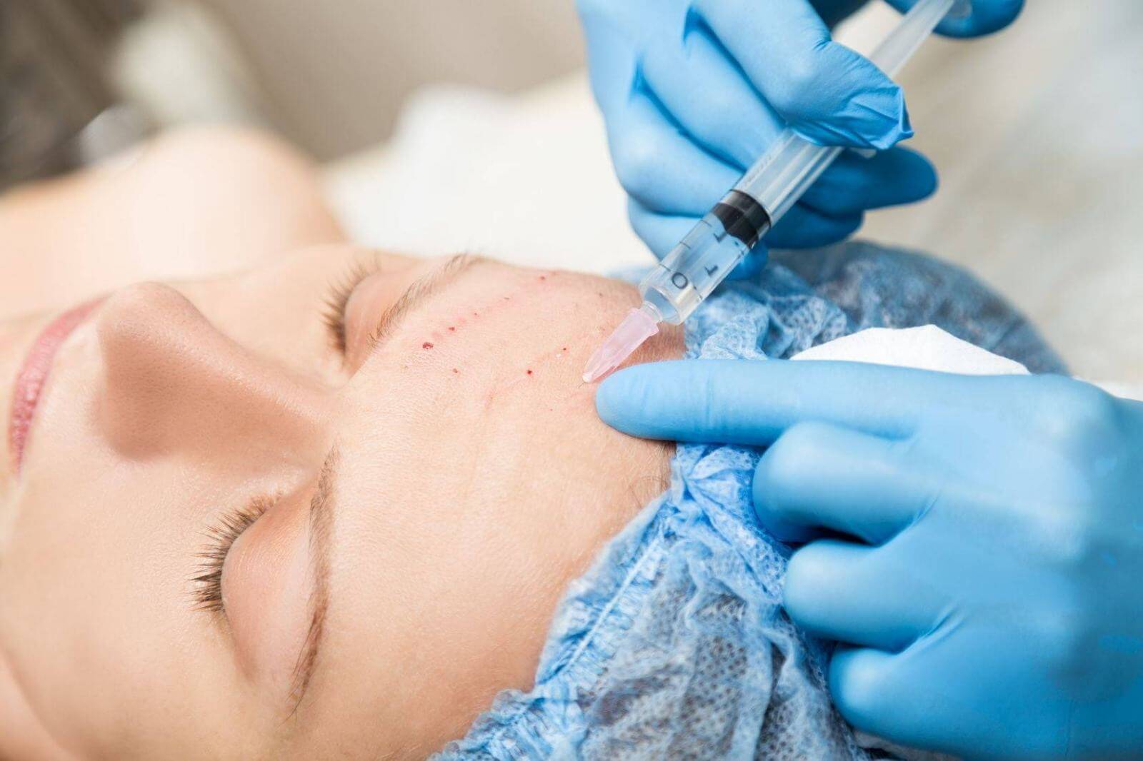 Мезотерапия против тусклой кожи лица