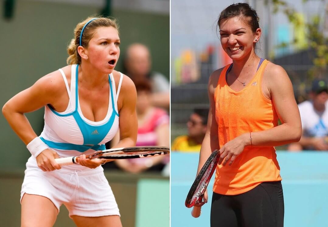 Симона Халеп не&nbsp;побоялась ни боли, ни критики фанатов и&nbsp;уменьшила грудь