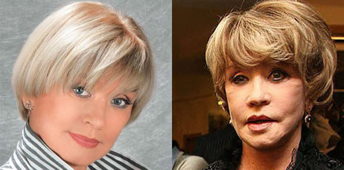 Вера Алентова до&nbsp;и&nbsp;после пластики