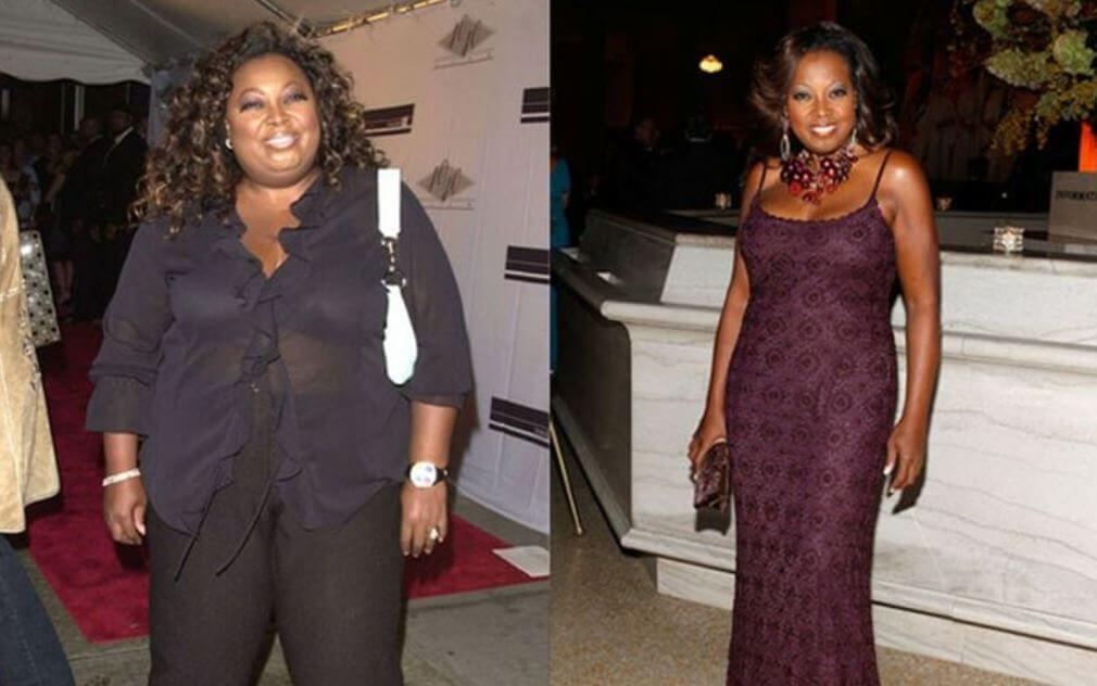 После сброса большого веса живот не&nbsp;может быть плоским и&nbsp;гладким без пластики. Стар Джонс знает это на&nbsp;собственном опыте