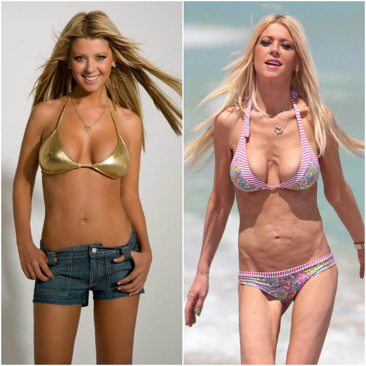 Тара Рид сильно изменилась со&nbsp;времен съемок в&nbsp;&laquo;Американском пироге&raquo;. Она все&nbsp;еще надеется, что пластика поможет ей полноценно вернуться в&nbsp;профессию