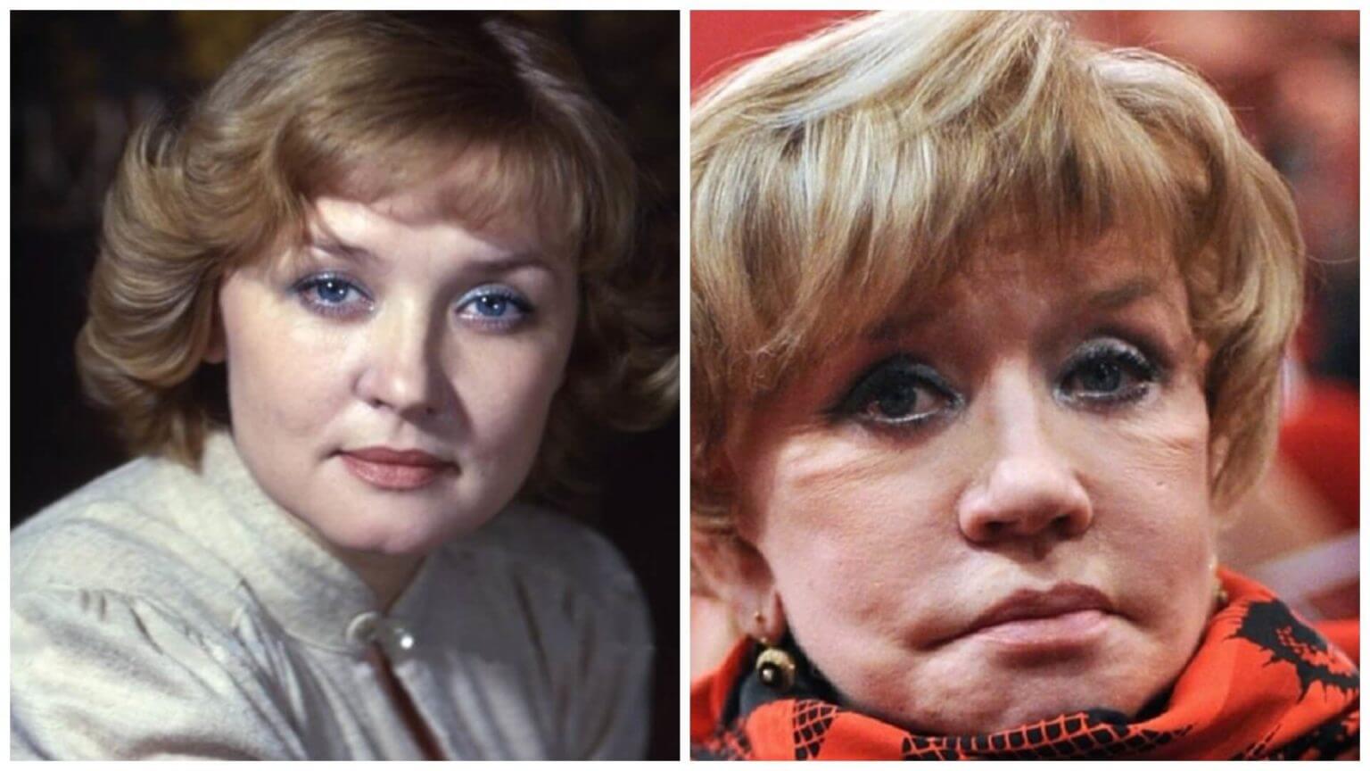 Вера Алентова – до и после пластики и ботокса