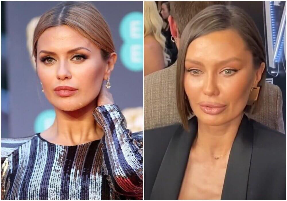 Виктория Боня до и после пластики в 2023 году