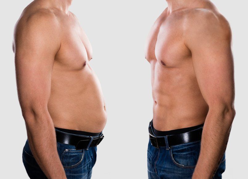 абдоминопластика для&nbsp;мужчин