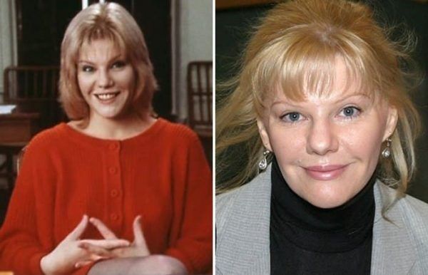 Александра Захарова до&nbsp;пластики