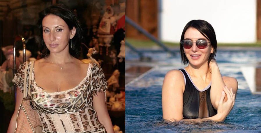 Алика Смехова маммопластика