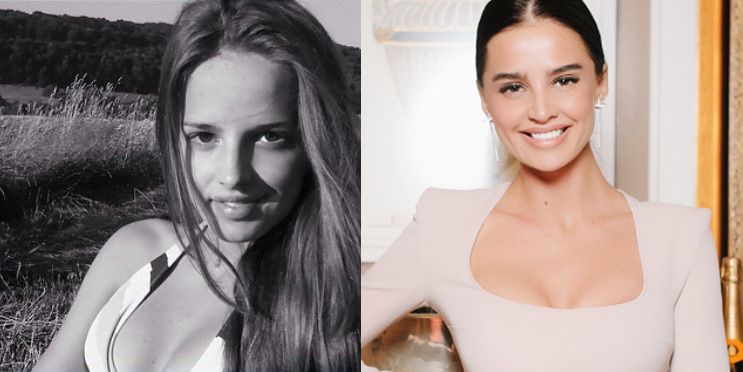 Анна Андрес пластика груди