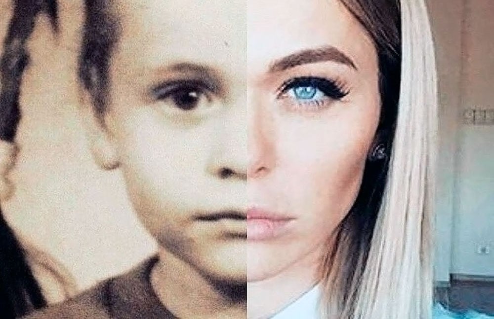 пластика у детей