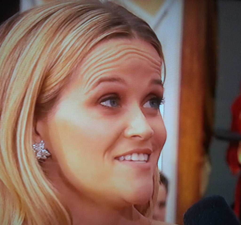 Морщины на лбу