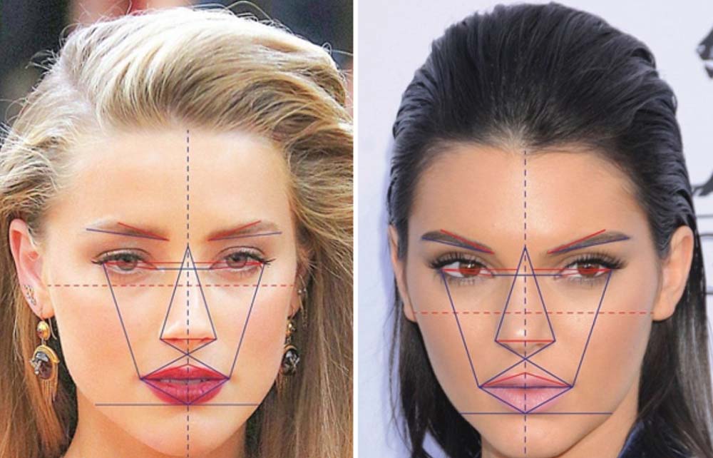 повторная пластика