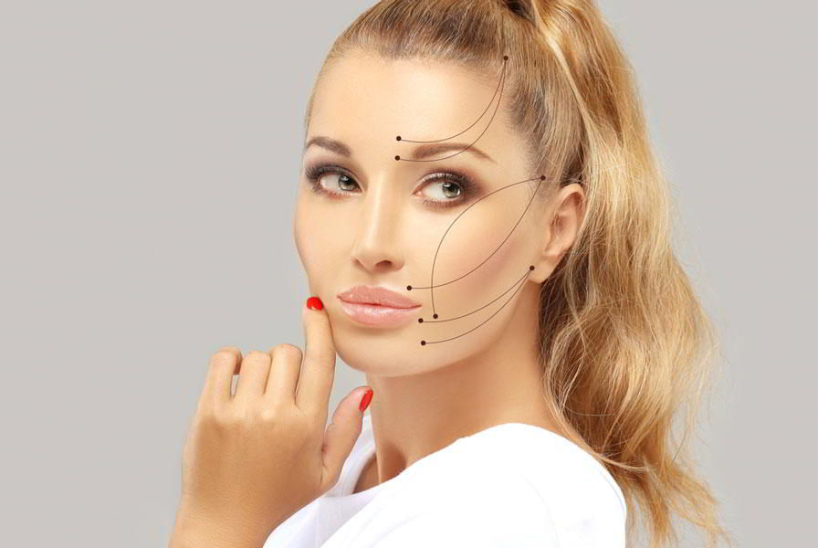 нитевой лифтинг лица