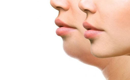 Шея и&nbsp;декольте4