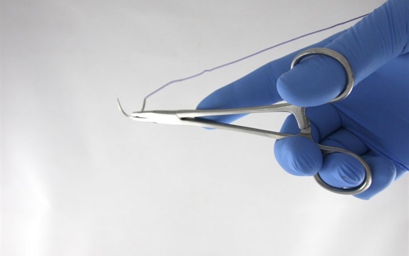 шов после пластики