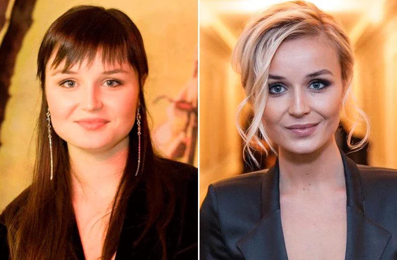 Результат удачной и уместной бишектомии