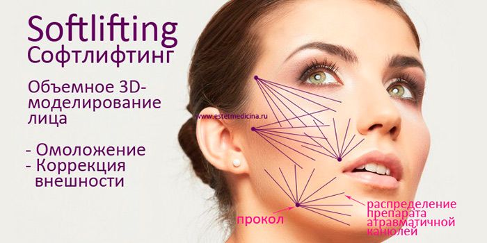 Софтлифтинг