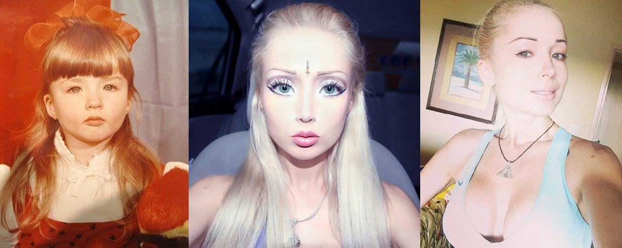 Глаза-блюдца До и После Барби из Одессы