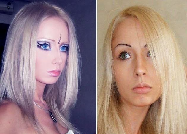 Пухлые губы у Барби из Одессы До и После