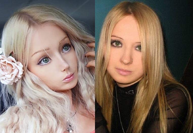 Нос Леры (Барби) До и После