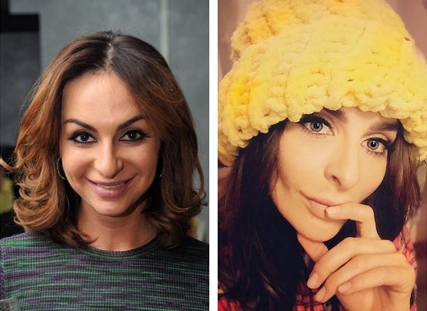 Екатерина Варнава до&nbsp;и&nbsp;после пластических операций