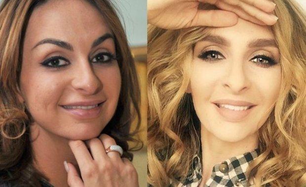 Екатерина Варнава до&nbsp;и&nbsp;после пластических операций