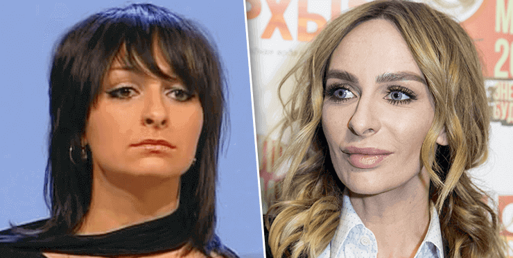 Екатерина Варнава до&nbsp;и&nbsp;после пластических операций