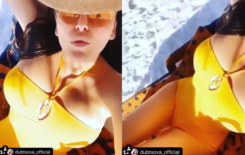 Пластика Дубцовой