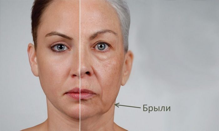 Что такое брыли