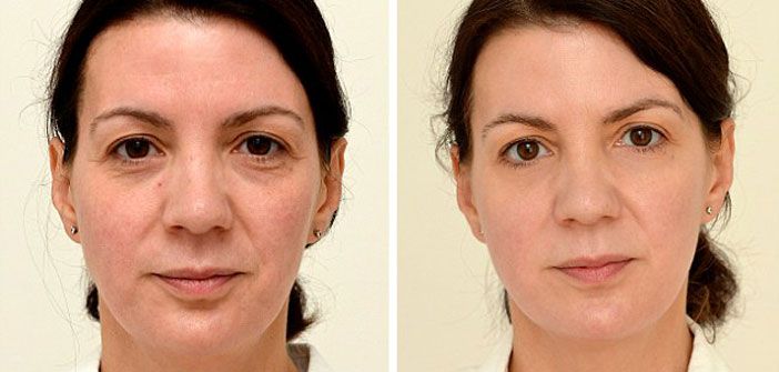 Пример NCTF 135