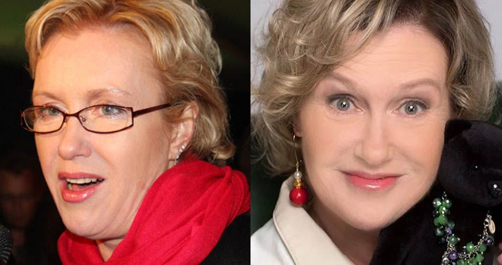 после пластики