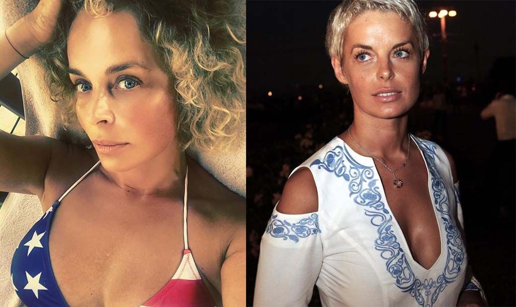 Калманович пластика груди