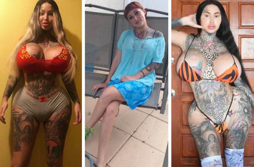 Канадка сделала пластику