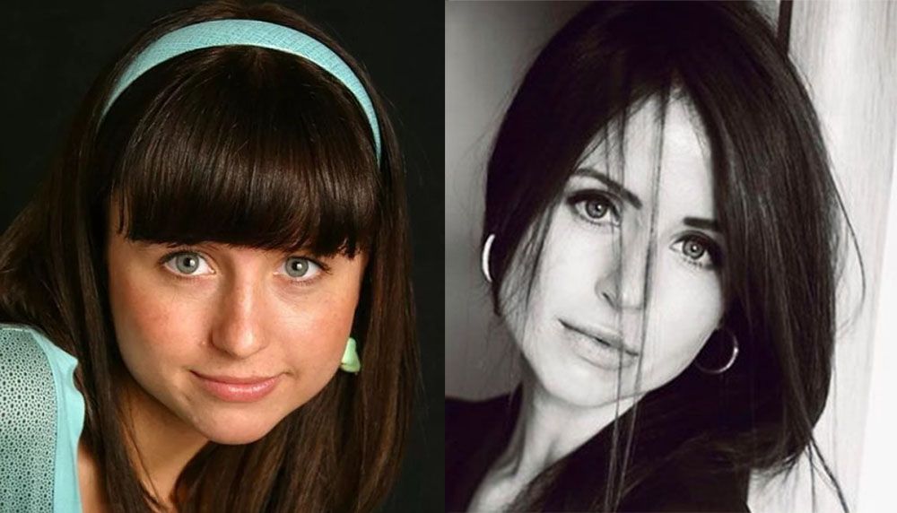 Пластика Карпович