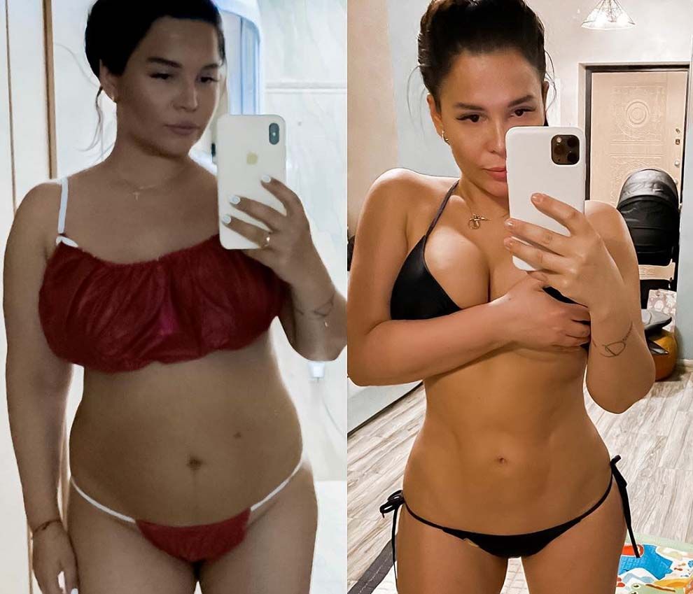 Катя Колисниченко после пластики