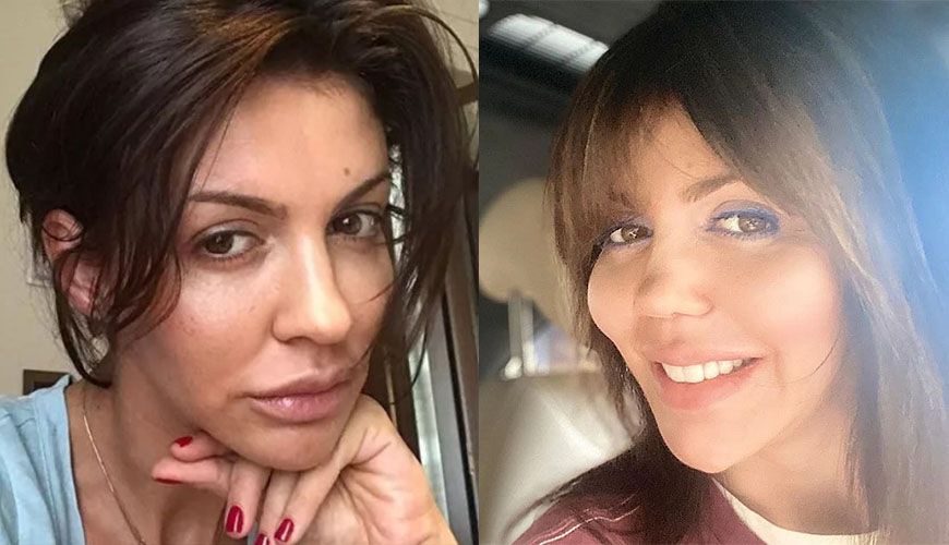 Алиса Казьмина до&nbsp;и&nbsp;после