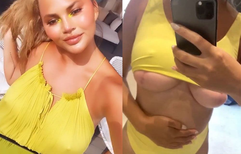 Шрамы на&nbsp;груди