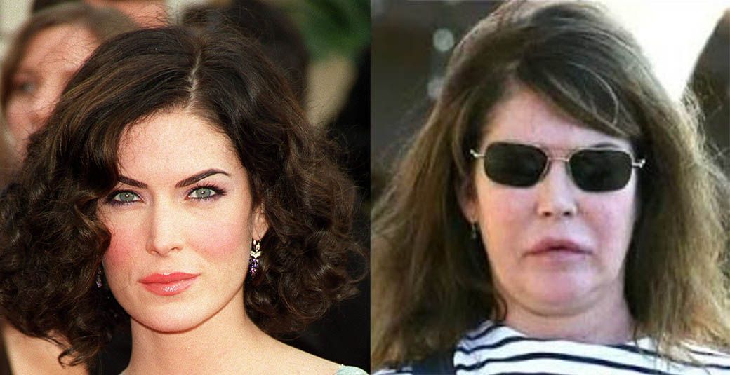 Лара Флинн Бойл после пластики