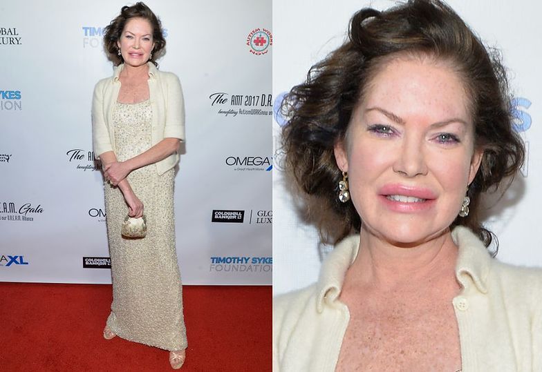 Лара Флинн Бойл жертва пластики