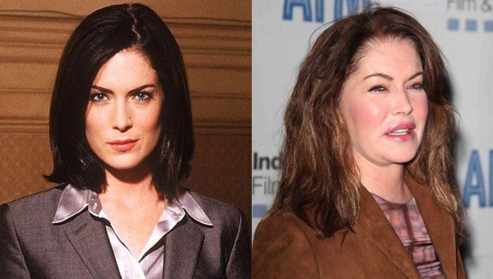 Лара Флинн Бойл неудачная пластика