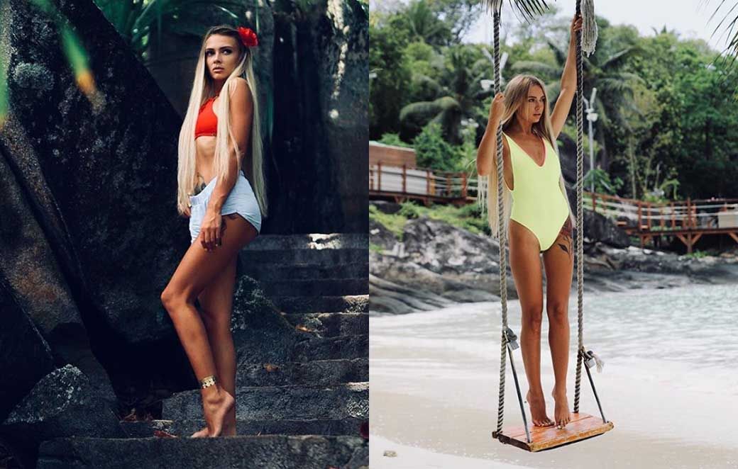 Ларченко до&nbsp;и&nbsp;после пластики