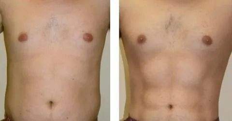 Моделирование мужского пресса