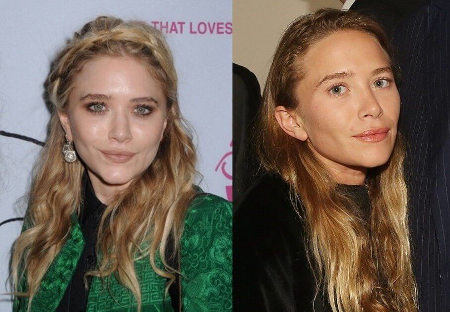 Мэри-Кейт Олсен пластика