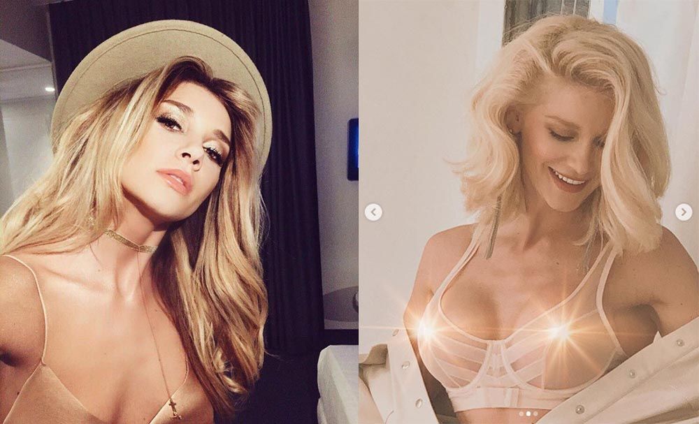 Миша Романова маммопластика