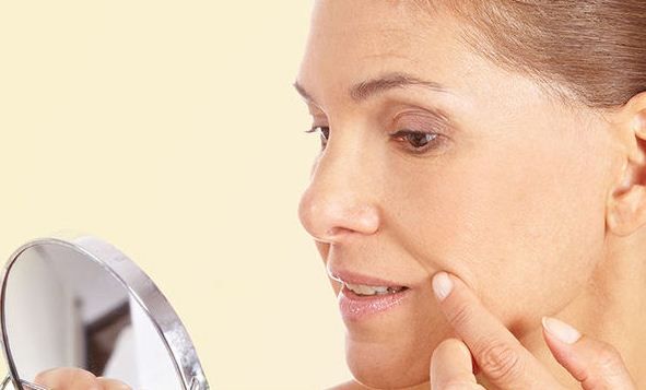 морщины-марионетки