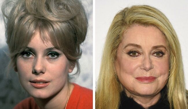 Деформационный или птозный тип проявления старения кожи лица