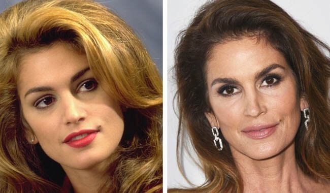 Мускульный тип проявления старения кожи лица