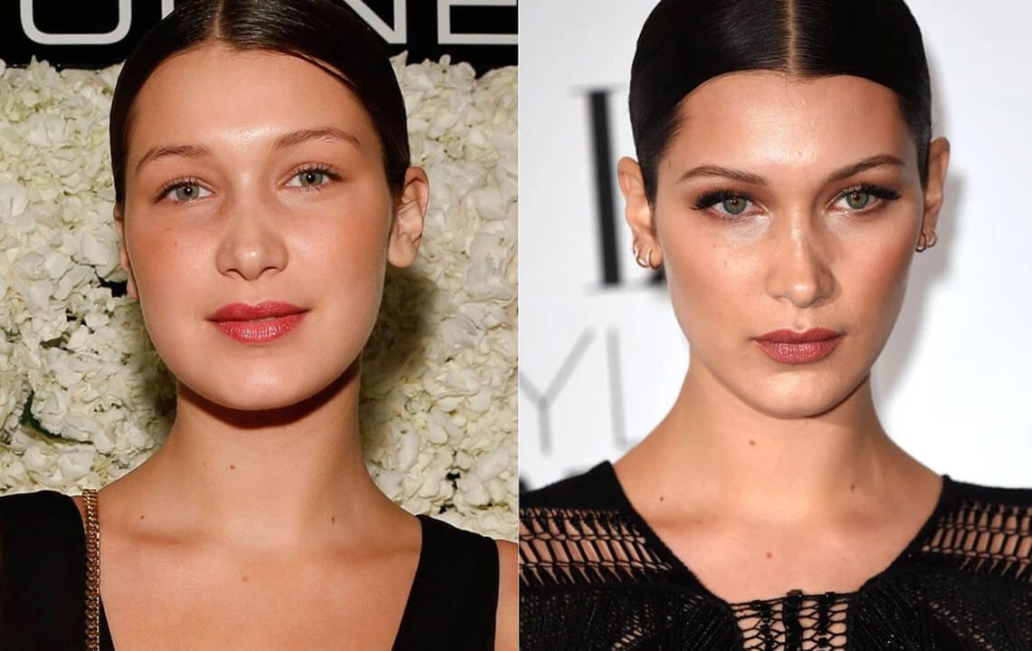 Белла Хадид до и после пластики