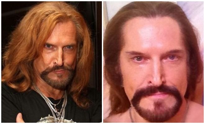 Джигурда до&nbsp;и&nbsp;после пластической хирургии