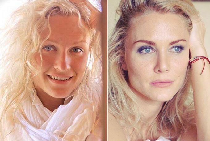 Катя Гордон с&nbsp;новым носом