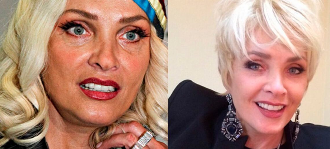 Лайма Вайкуле до и после пластики